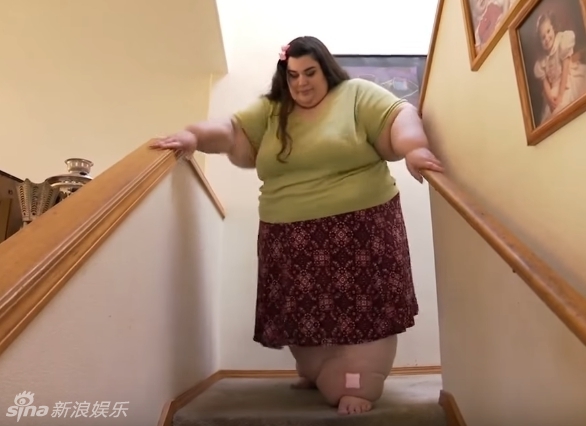  article>组图:580斤胖妹成功瘦身 网友:赫本再现!